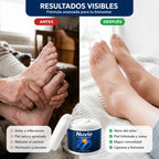 Crema Nuvia | Alivio de Neuropatía, Ardor y Piernas Pesadas