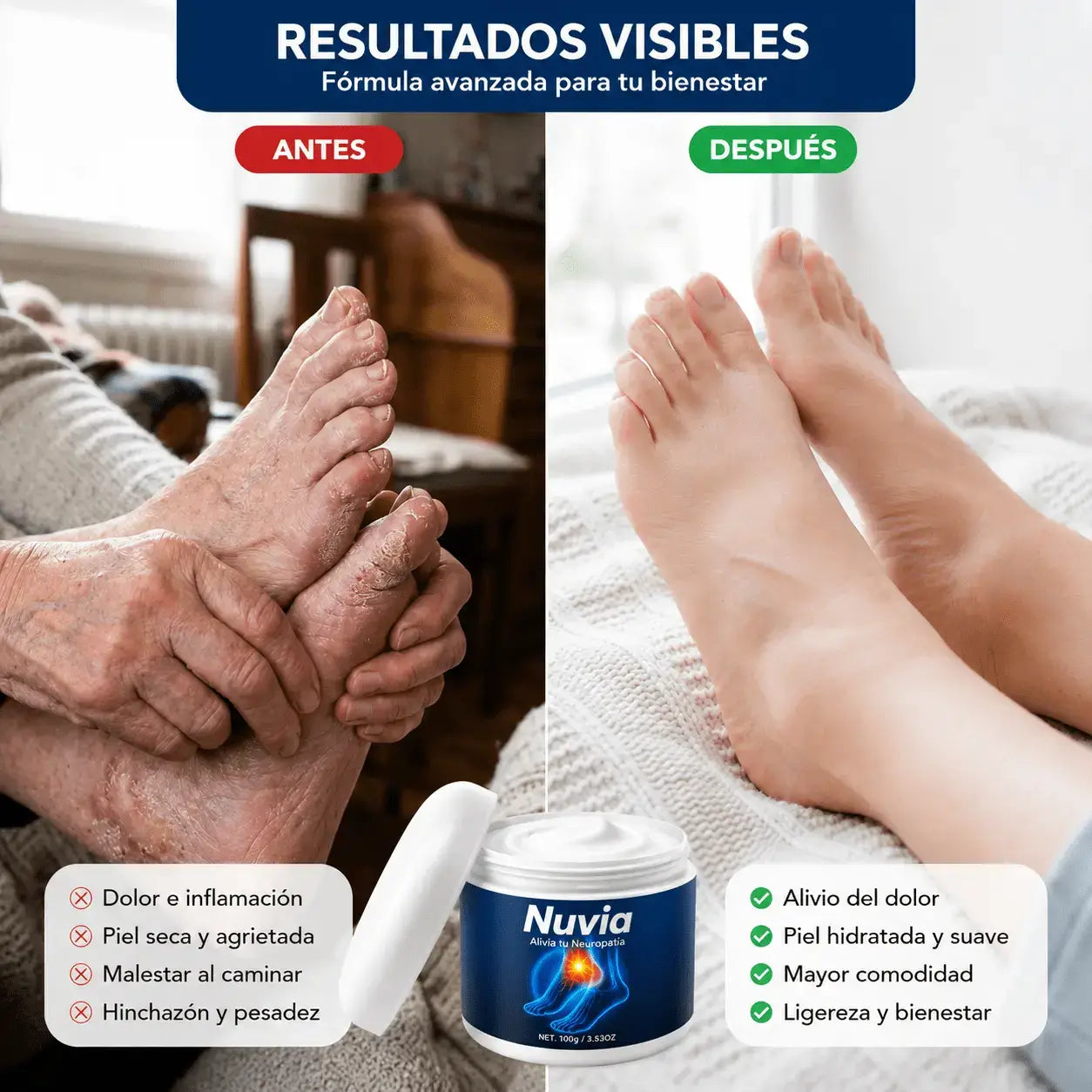 Crema Nuvia | Alivio de Neuropatía, Ardor y Piernas Pesadas